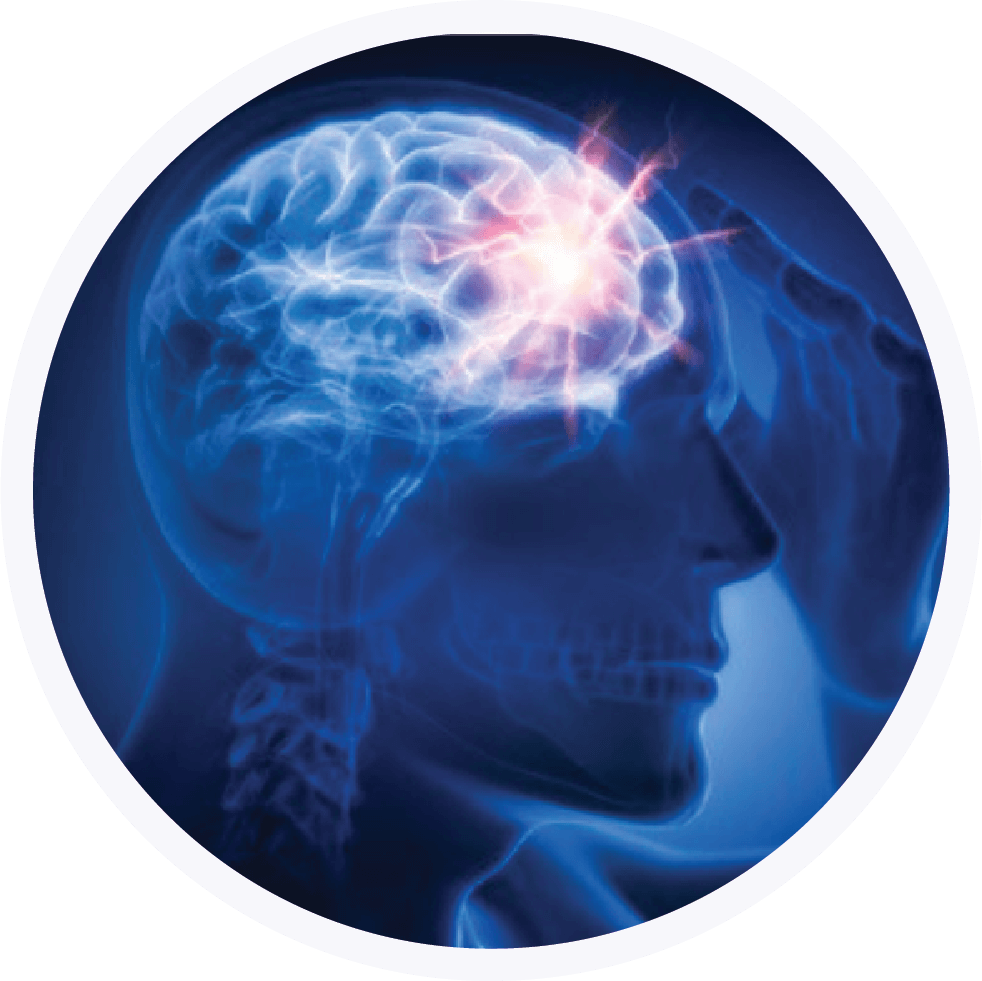 Neurology and Concussions