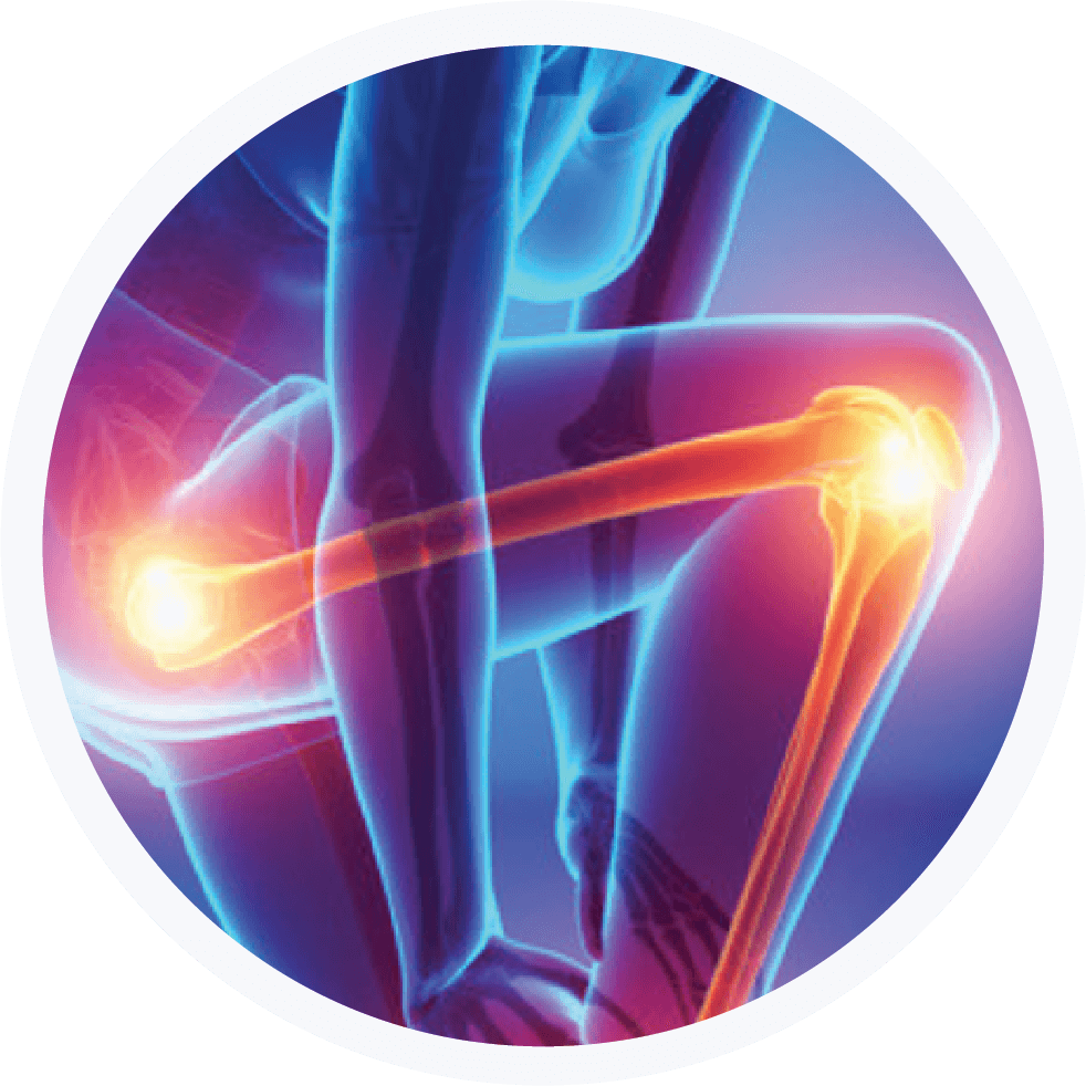 Knee and Hip Pain